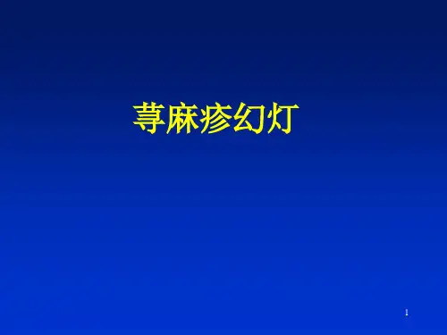 荨麻疹幻灯参考PPT