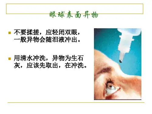 院前急救知识课件(1).ppt