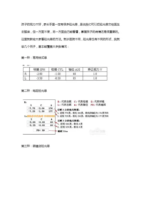 看懂验光单