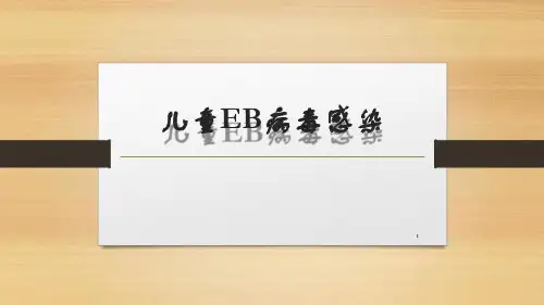 儿童EB病毒感染ppt课件