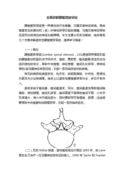 全面讲解腰椎管狭窄症