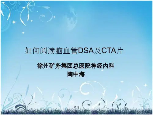 脑血管造影及CTAppt课件