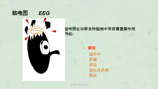 脑电图及其临床应用ppt课件
