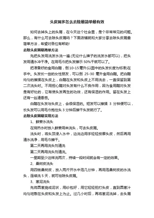头皮屑多怎么去除最简单最有效