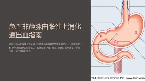 急性非静脉曲张性上消化道出血指南