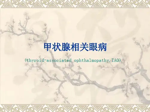甲状腺相关眼病
