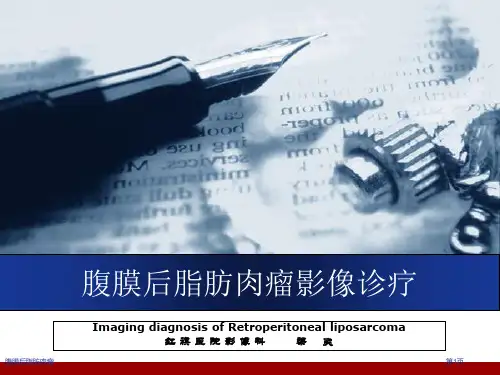 腹膜后脂肪肉瘤
