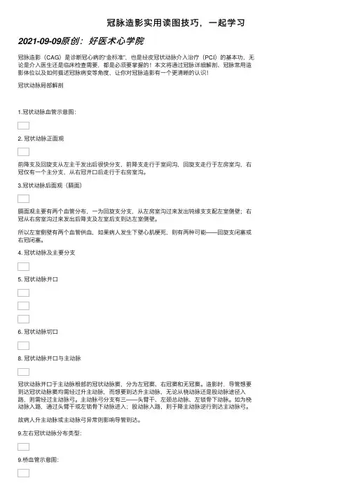 冠脉造影实用读图技巧，一起学习