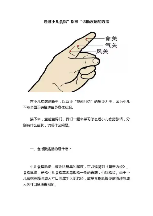 通过小儿食指”指纹“诊断疾病的方法