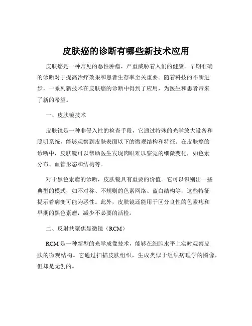 皮肤癌的诊断有哪些新技术应用