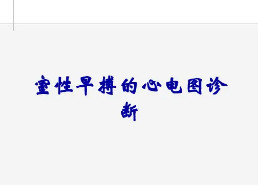 室性早搏的心电图诊断