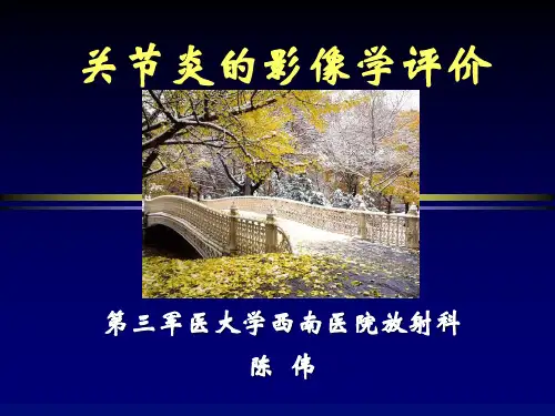 关节炎的影像学评价课件