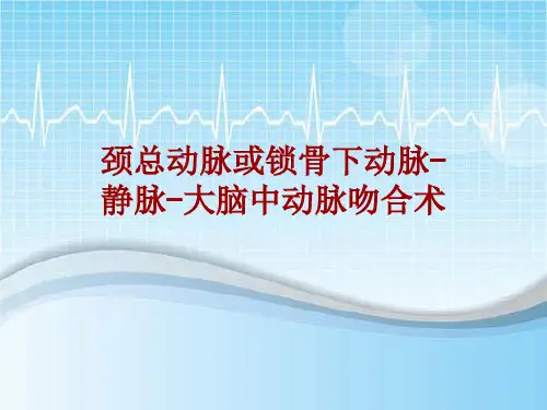 手术讲解模板：颈总动脉或锁骨下动脉-静脉-大脑中动脉吻合术