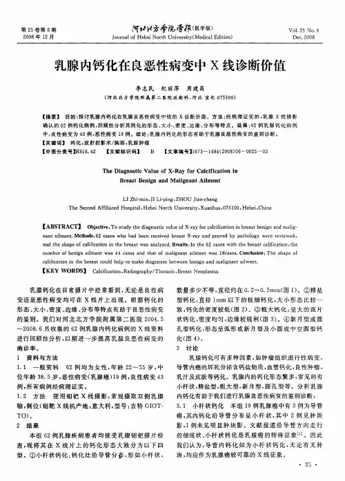 乳腺内钙化在良恶性病变中X线诊断价值
