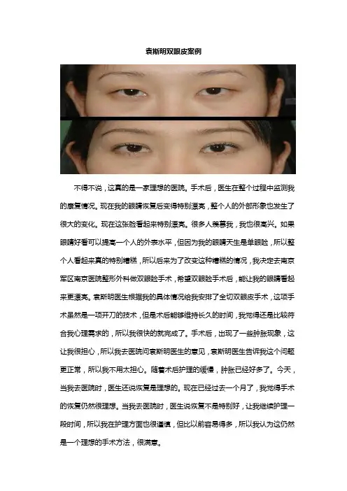 袁斯明双眼皮案例