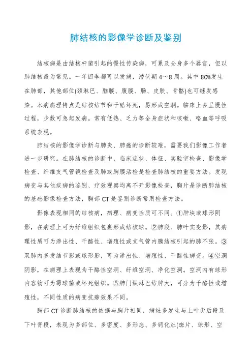 肺结核的影像学诊断及鉴别