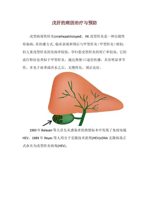 戊肝的病因治疗与预防
