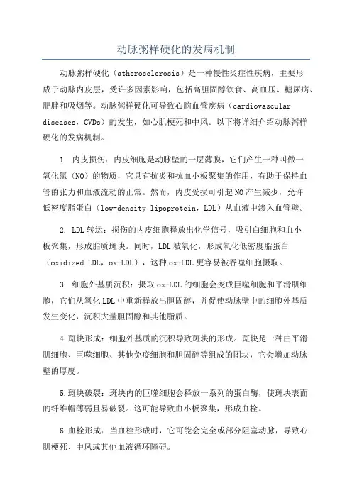 动脉粥样硬化的发病机制