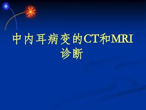 中内耳病变的CT和MRI诊断