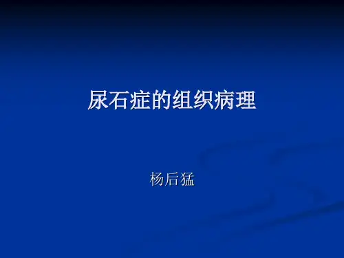 肾结石的组织病理PPT课件