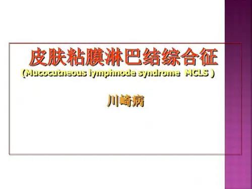 川崎病(儿科 ppt课件