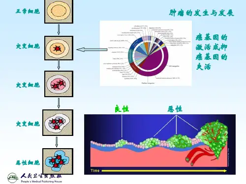 核医学课件 12第12章 肿瘤显像