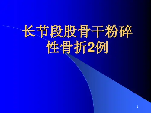 长节段股骨干粉碎性骨折PPT课件
