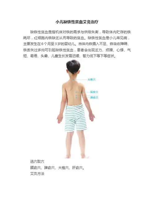 小儿缺铁性贫血艾灸治疗