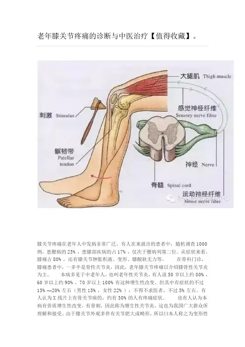 老年膝关节疼痛的诊断与中医治疗【值得收藏】