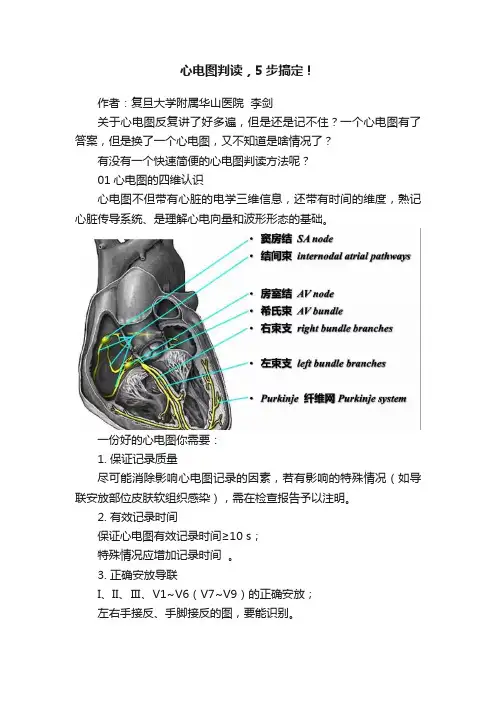 心电图判读，5步搞定！