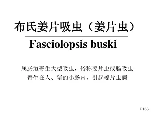 医学微生物学PPT：姜片虫 肺吸虫
