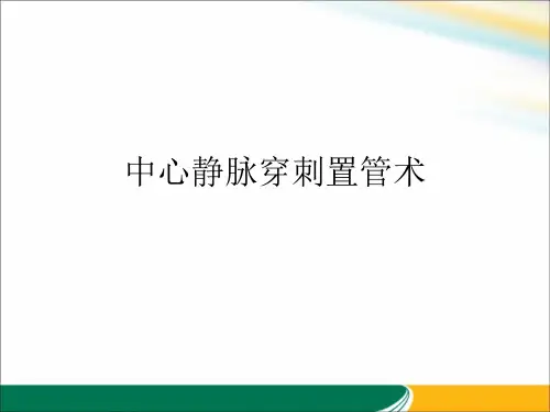 中心静脉穿刺置管术