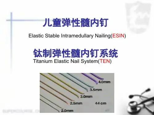 弹性髓内钉幻灯片课件
