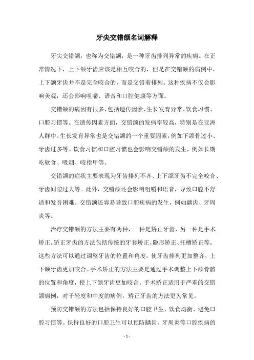 牙尖交错颌名词解释