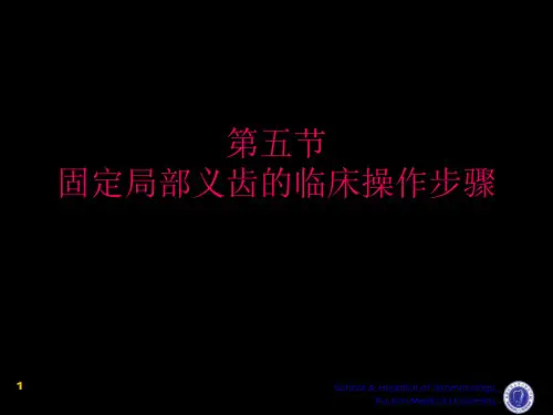 口腔修复学：第四章 第五节 固定局部义齿的临床操作步骤