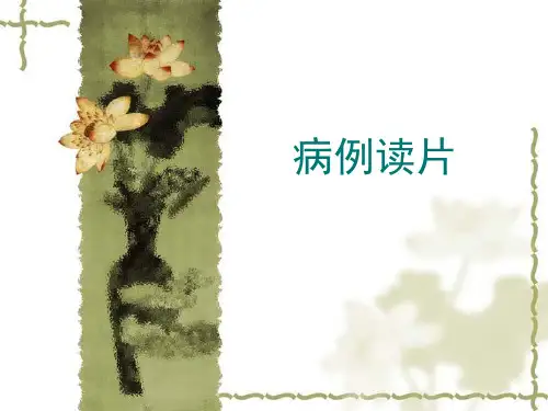 颅内海绵状血管瘤影像诊断