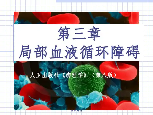 病理学 局部血液循环障碍ppt课件
