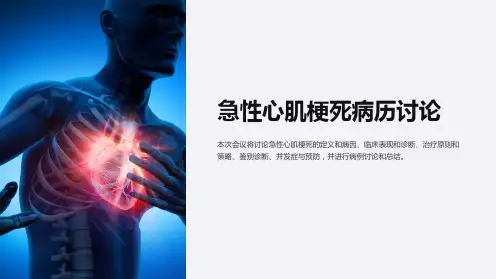 急性心肌梗死病历讨论