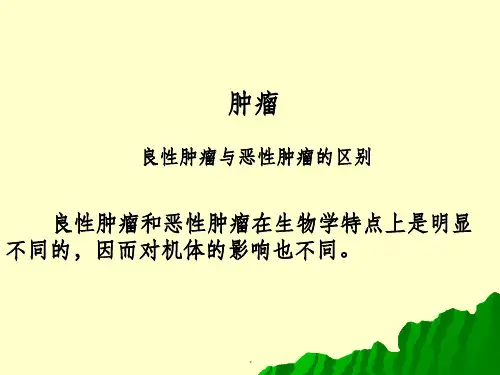 良性肿瘤与恶性肿瘤的区别ppt课件