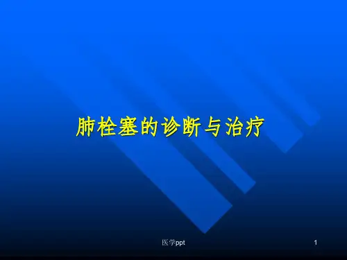 肺栓塞的诊断与治疗