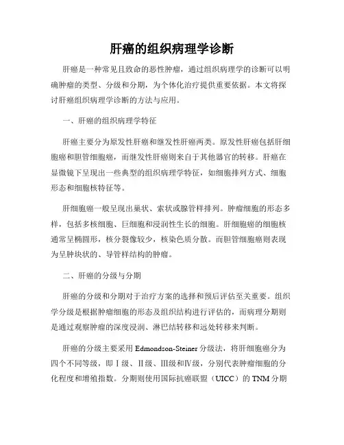 肝癌的组织病理学诊断