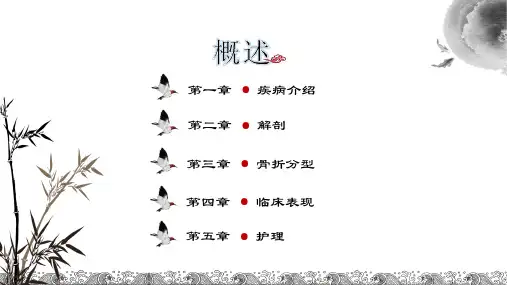 股骨粗隆间骨折的护理常规-杨盼ppt课件