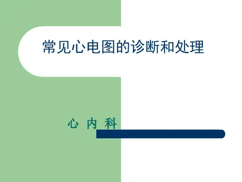 常见心电图的诊断和处理
