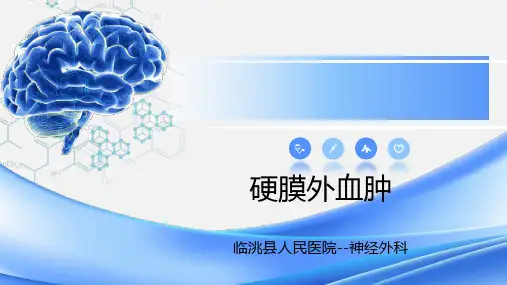 硬膜外血肿