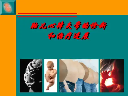 胎儿心律失常