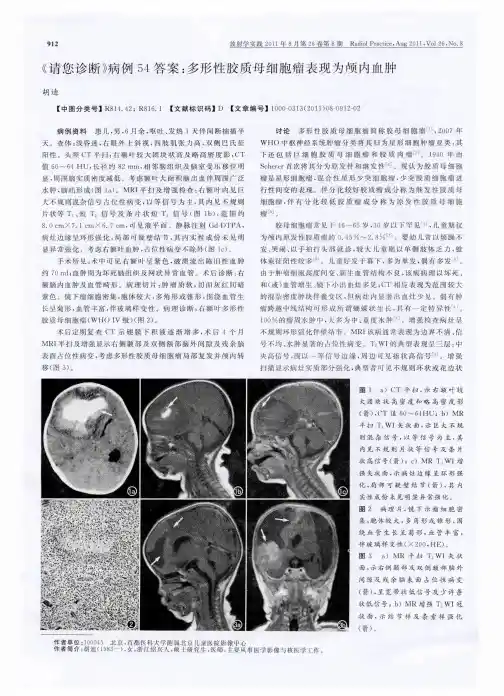 《请您诊断》病例54答案：多形性胶质母细胞瘤表现为颅内血肿