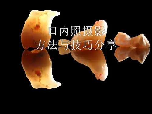 口腔摄影方法与技巧