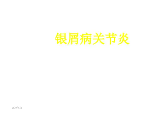 银屑关节炎张奉春课件