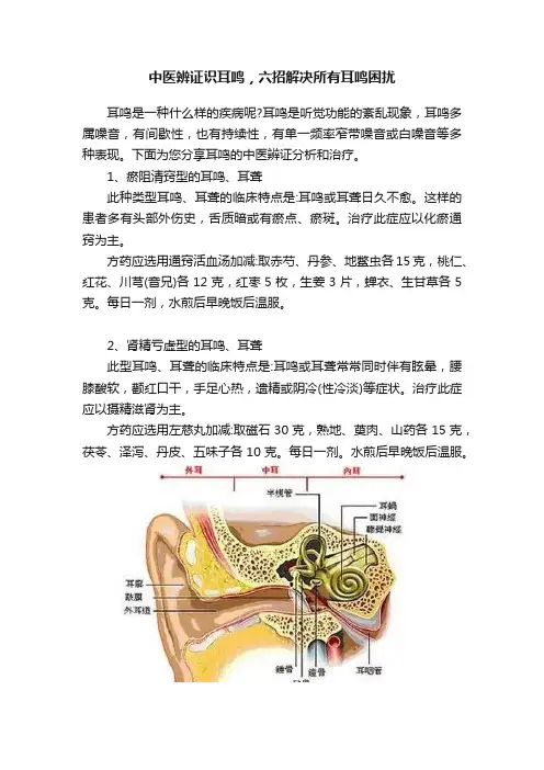 中医辨证识耳鸣，六招解决所有耳鸣困扰
