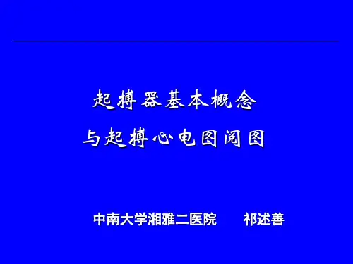 起搏器基本概念及起搏心电图阅图